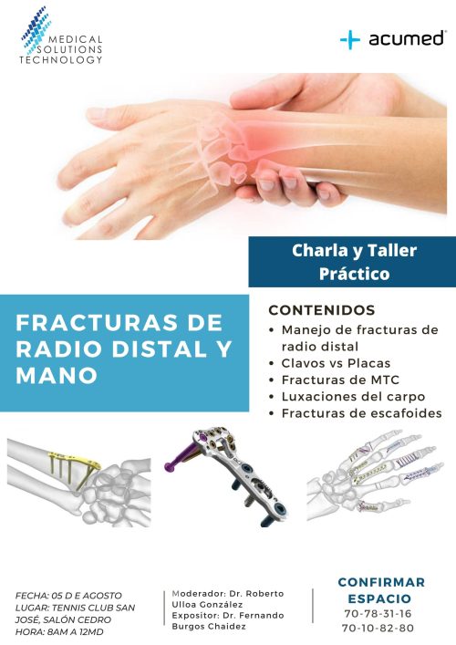 Actividad Radio y Mano Residentes